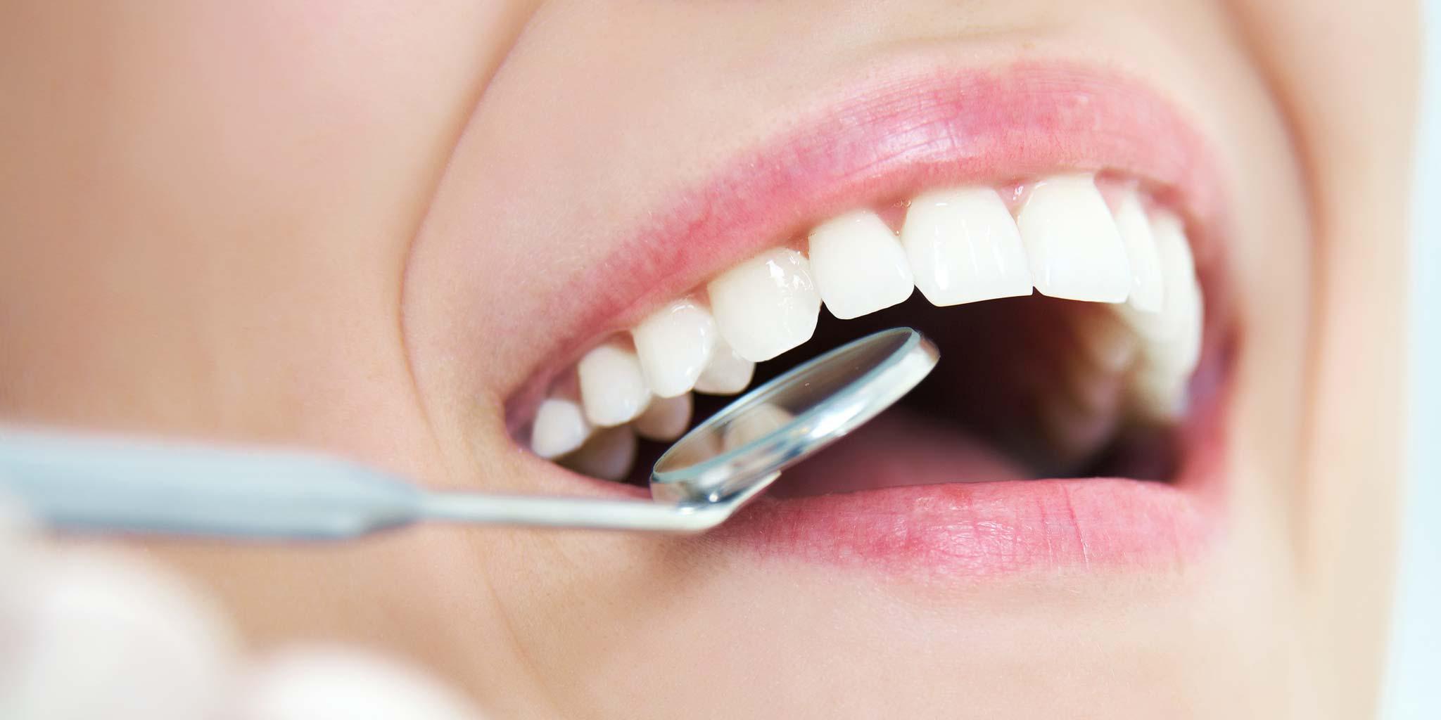 دراسة: السكر يُطلق تفاعلات فورية تُضعِف مينا الأسنان خلال دقائق