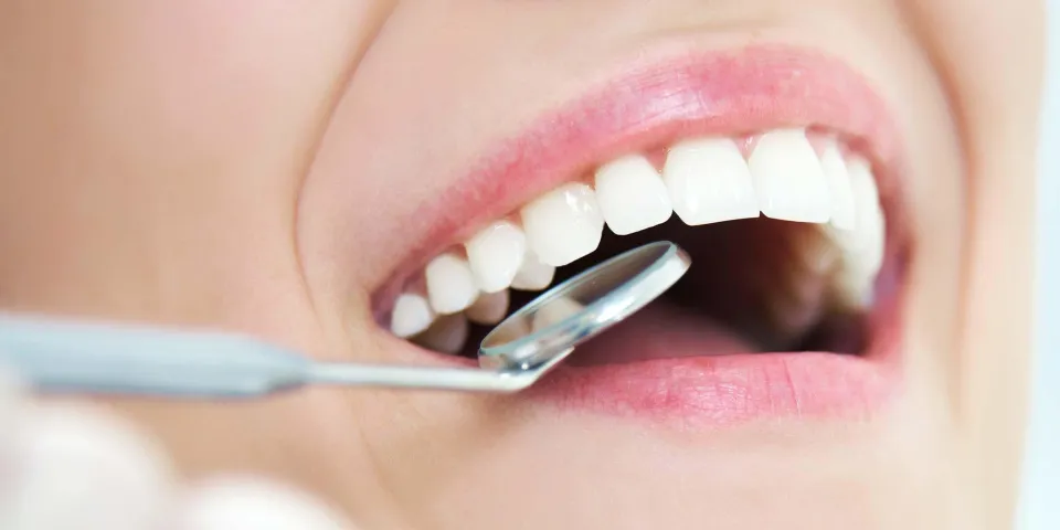 دراسة: السكر يُطلق تفاعلات فورية تُضعِف مينا الأسنان خلال دقائق