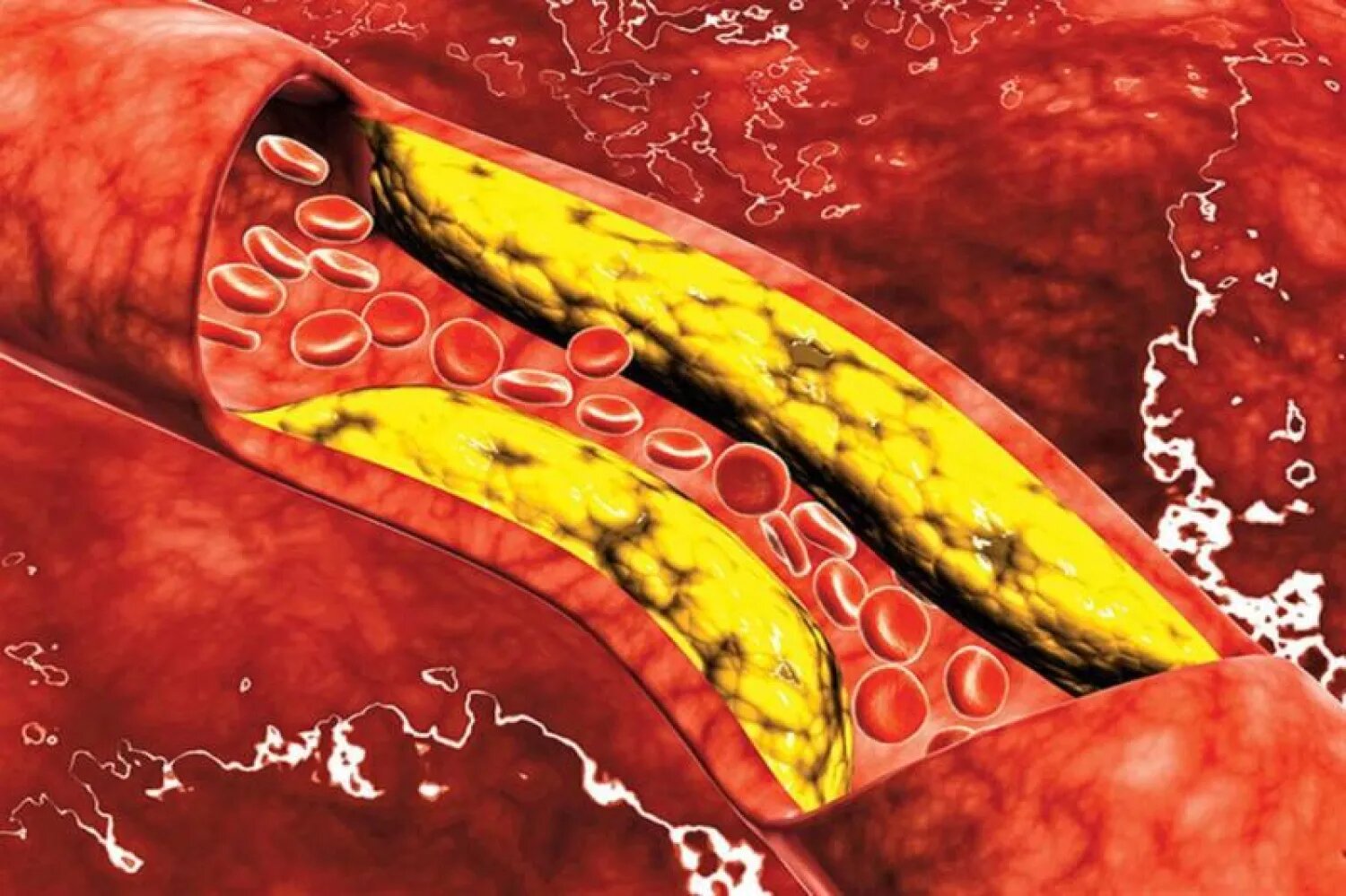 ما الفرق بين