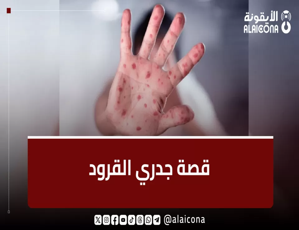  رحلة فيروس جدري القرود