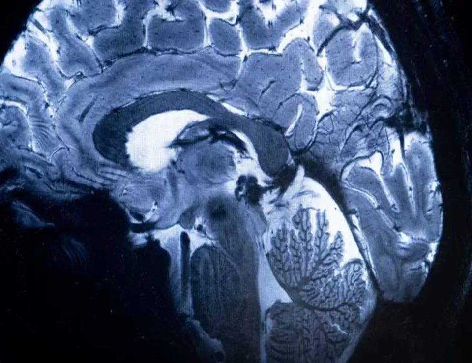 دراسة تكشف تأثير فيروس كورونا على جذع الدماغ الذي "يتحكم في الحياة"