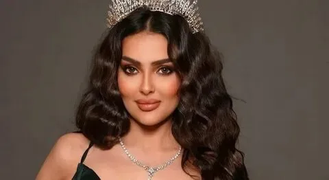 «رومي القحطاني» ملكة جمال السعودية تصرح عن تشوه في وجهها