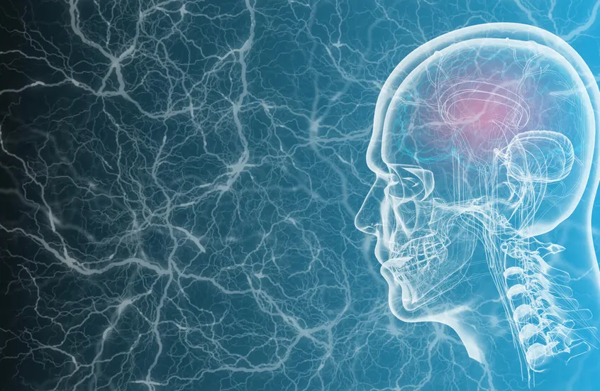 دراسة أمريكية: تلوث الهواء قد يزيد خطر الإصابة بنزيف الدماغ