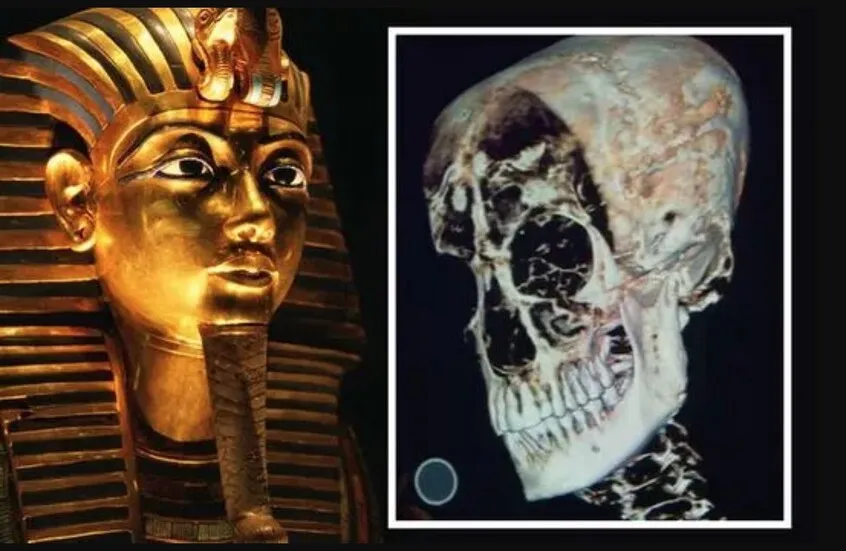 زاهي حواس يكشف الحقيقة الكاملة وراء وفاة توت عنخ آمون زاهي حواس يكشف الحقيقة الكاملة وراء وفاة توت عنخ آمون